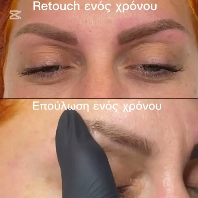 Ρετούς χρόνου με χρήση @ecuri_cosmetics_pmu

#κεντροαισθητικης #κέντροαισθητικής #φρυδια #τατουφρυδια #τατουφρυδιων #ημιμονιμομακιγιαζ #eyebrow #eyebrows #eyebrowstattoo #eyebrowtattoo #τατουαζ #τατουάζφρυδιών #φρυδιασκίαση #φρυδιατρίχατρίχα #φρυδιαταττοο #φρύδια_σχήμα